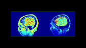 thumbnail of medium AR NeuroVision - Intro - OHBM2025